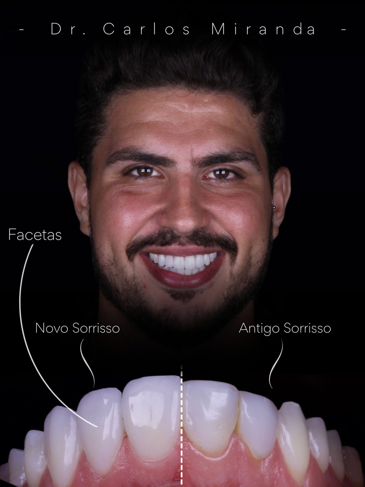 Comparativo de transformação do sorriso